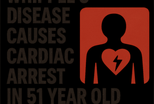 Whipple’s Disease Causes Cardiac Arrest in 51-Year-Old image